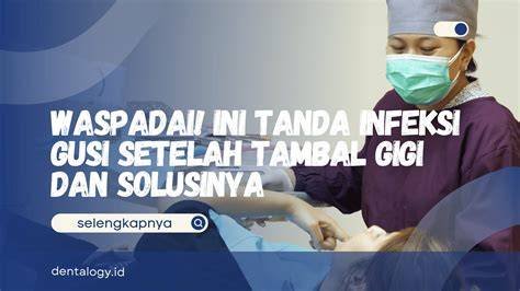 Mengapa ‘Tambal Gigi Online’ Berujung Infeksi? Simak Penjelasan Lengkap dan Risiko yang Membuat Orang Tetap Membeli