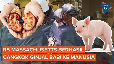 Rekor hidup terlama dengan ginjal babi: Pria AS bertahan 271 hari sebelum akhirnya menerima transplantasi ginjal manusia