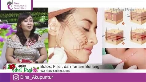 Botoks, Tanam Benang, dan Filler: Simak Penjelasan Lengkap Fatwa MUI tentang Status Halal atau Haramnya Praktik Kecantikan Ini